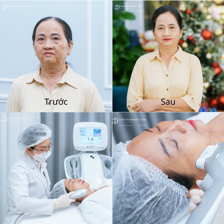 Viện Thẩm Mỹ Diva