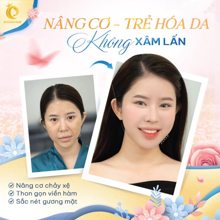 Viện Thẩm Mỹ Shinhan