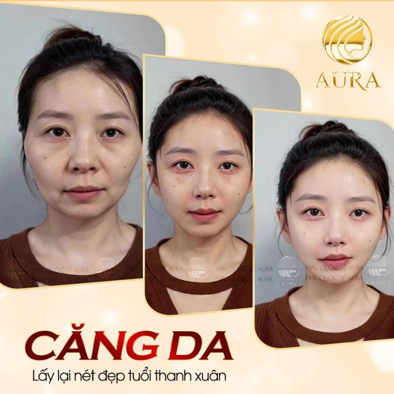 Thẩm Mỹ Viện Quốc Tế Aura
