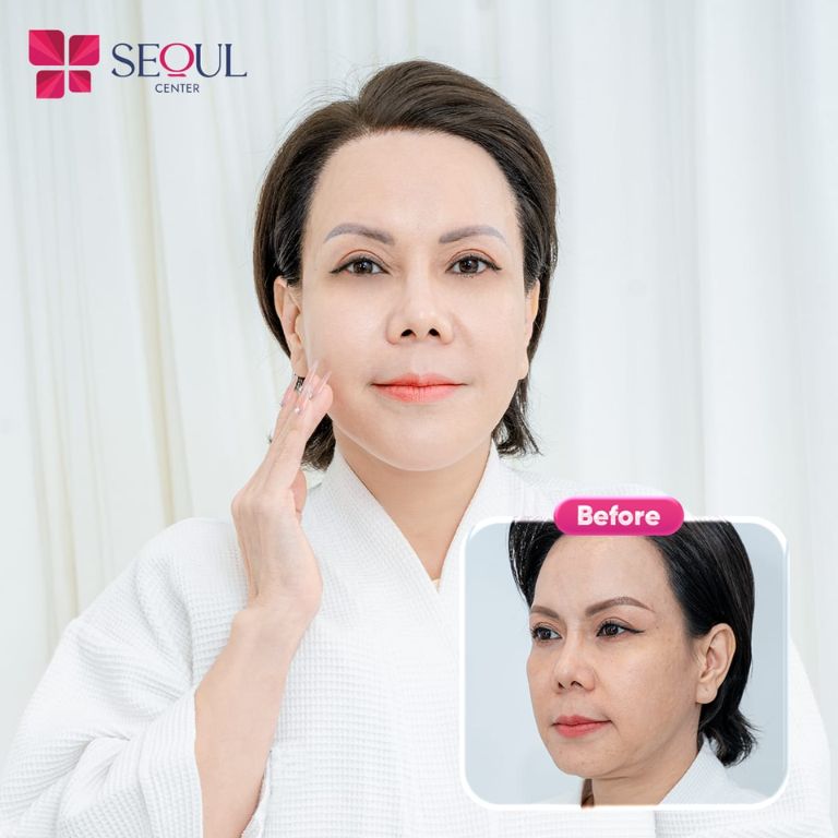 Thẩm mỹ viện Seoul Center