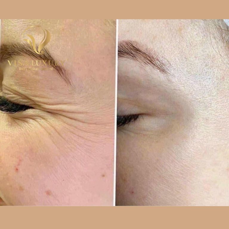 Viện thẩm mỹ Quốc tế VISA