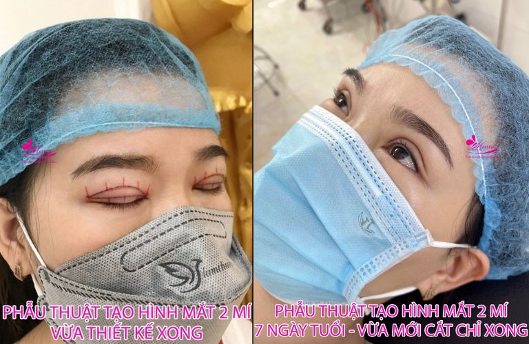 Thẩm mỹ viện Mailisa