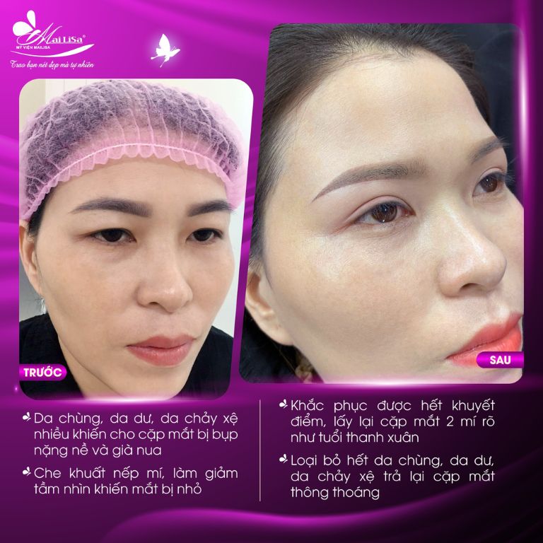 Thẩm mỹ viện Mailisa