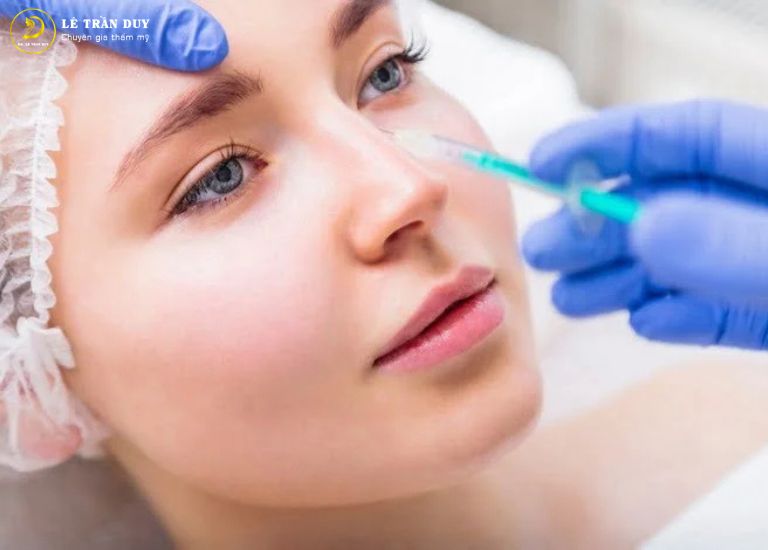 Chi phí tiêm filler mũi vào khoảng 15.000.000 VNĐ – 30.000.000