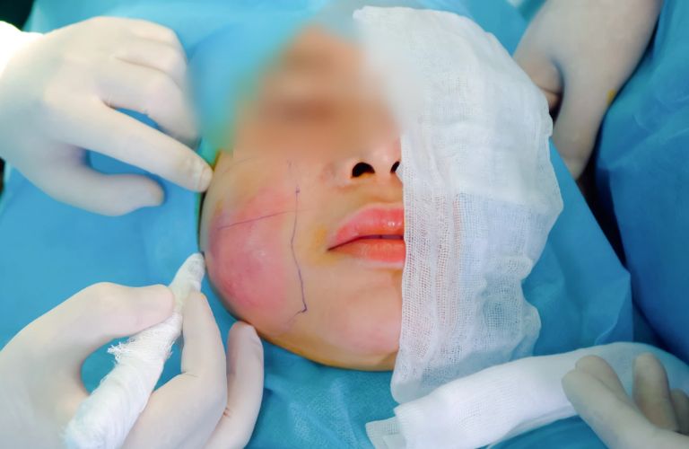 Đến ngay cơ sở y tế chuyên khoa thẩm mỹ hoặc da liễu