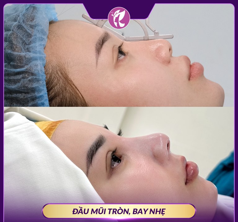 Khoa Phẫu Thuật Tạo Hình Thẩm Mỹ - Đại Học Đà Nẵng là địa chỉ nâng mũi chất lượng