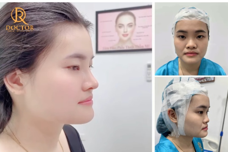 Thẩm Mỹ Quốc Tế Doctor là địa chỉ nâng mũi đẹp tại Đà Nẵng