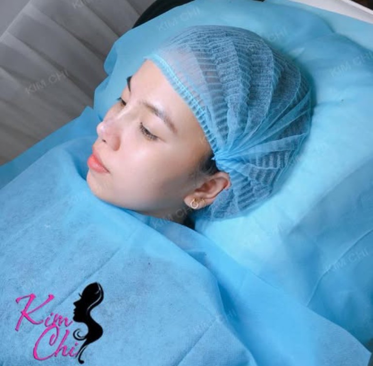 Địa chỉ nâng mũi chất lượng tại Dĩ An