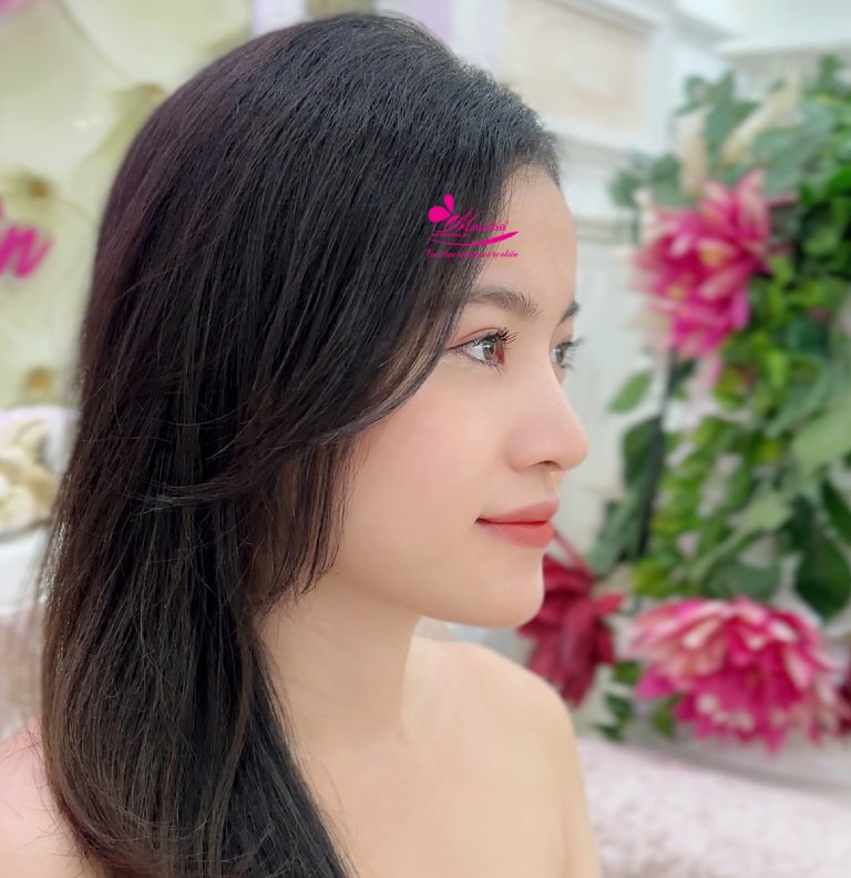 địa chỉ Thẩm Mỹ Viện Mailisa nâng mũi tại Khánh Hòa