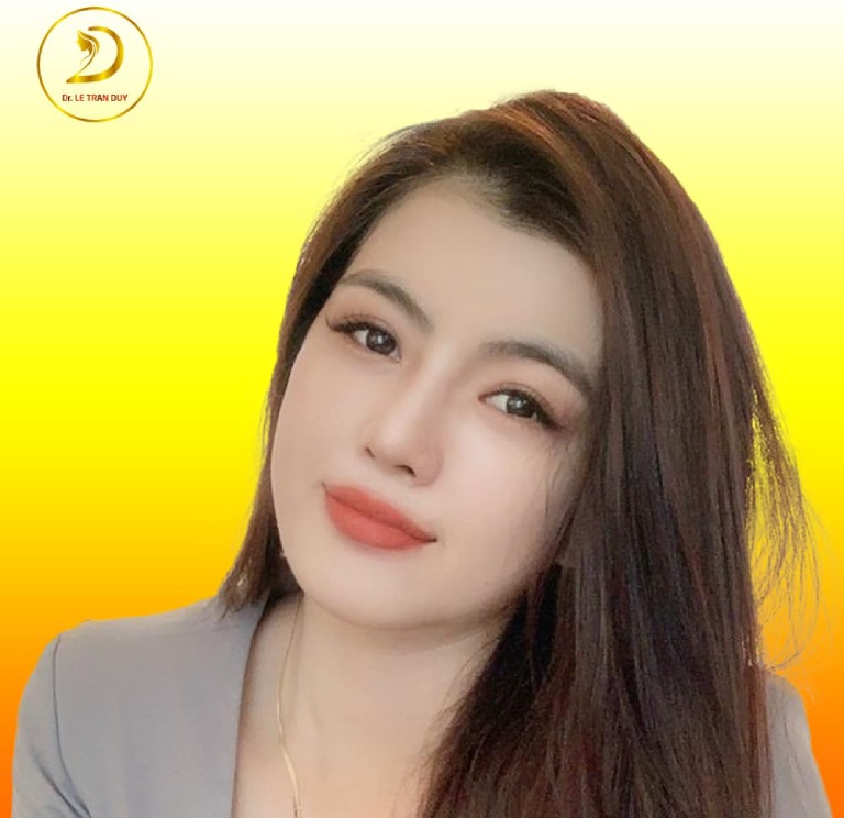 Địa chỉ nâng mũi tại Long An 
