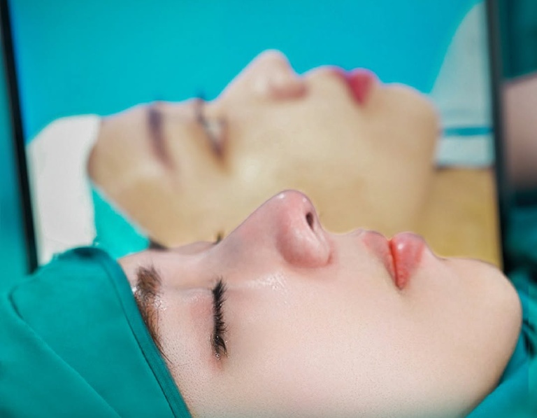 Viện Thẩm Mỹ Quốc Tế Elia nâng mũi tại quận 3