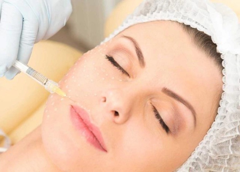 đang cho con bú tiêm Filler có được không