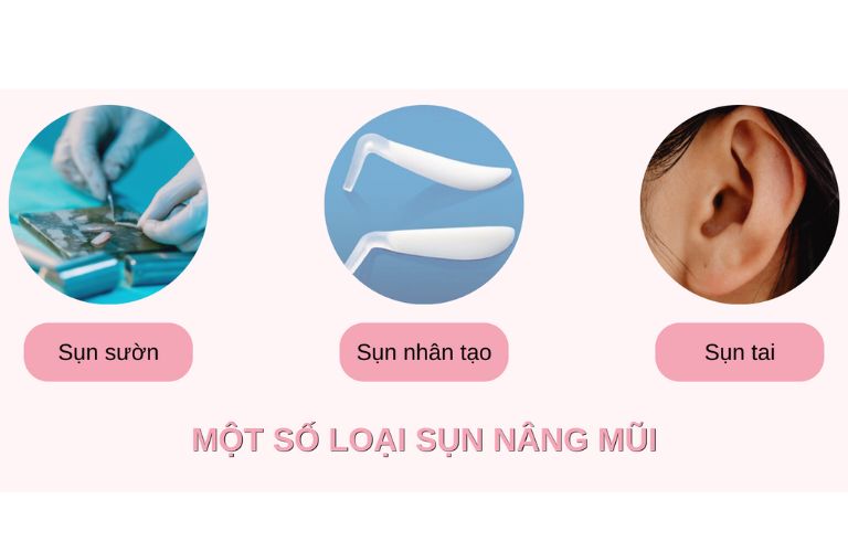 Thời gian hồi phục và ổn định sau nâng mũi có thể nhanh hay chậm còn phụ thuộc vào loại sụn nâng mũi