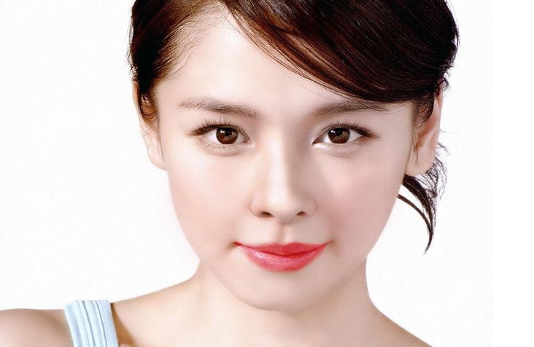 Nâng mũi bị lệch