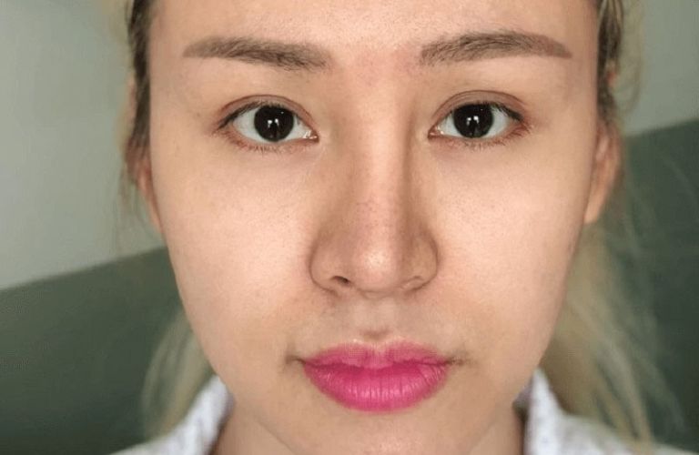Quan sát sự đối xứng của mũi