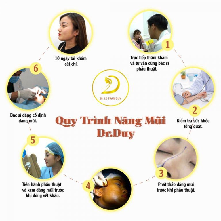 Nâng mũi cấu trúc 4D Nanoform tại Thẩm mỹ Dr Duy