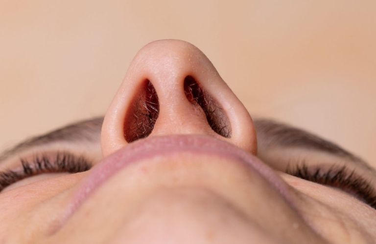 Người có trụ mũi yếu hoặc thiếu vững chắc