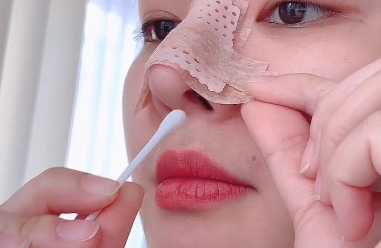 Thời gian hồi phục lâu hơn so với những phương pháp khác