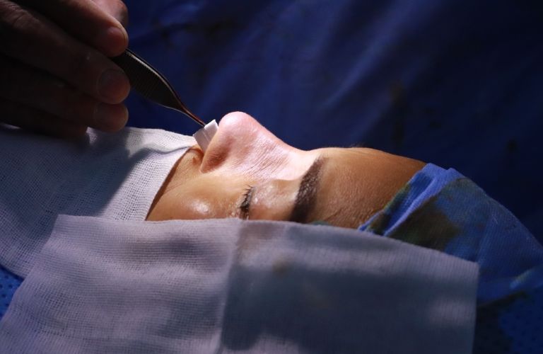 Quy trình phẫu thuật nâng mũi dựng trụ