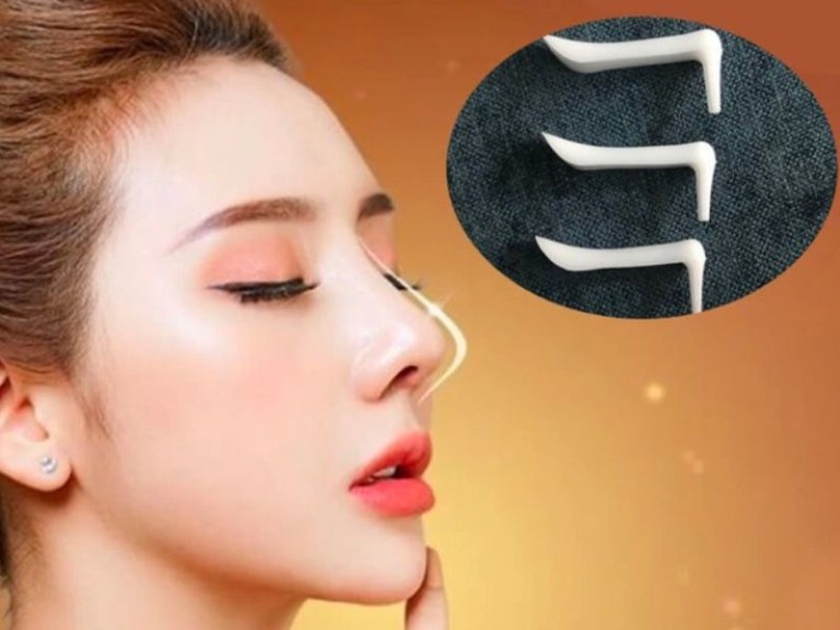 yếu tố quyết định nâng mũi giữ được bao lâu