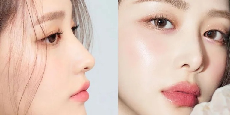Nâng mũi bao lâu thì gom lại