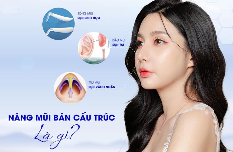 Nâng mũi bán cấu trúc