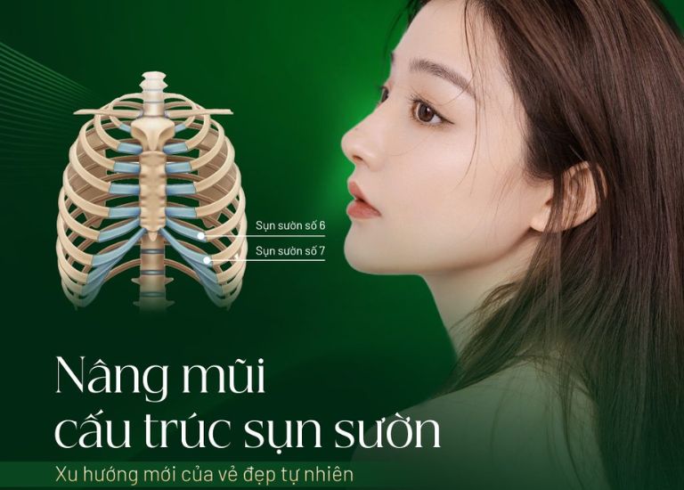 Nâng mũi bằng sụn sườn tự thân 100%