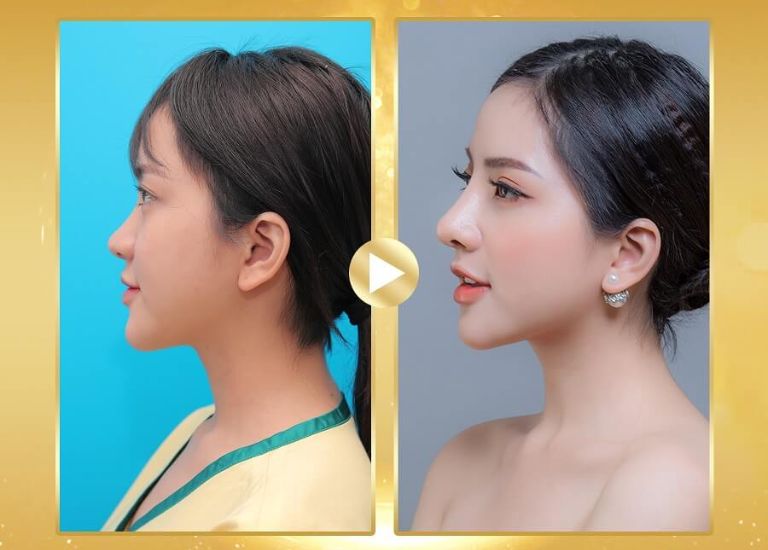 Cần tìm hiểu và lựa chọn cơ sở thẩm mỹ uy tín tại Đài Loan để đảm bảo an toàn