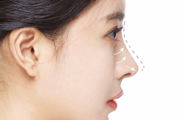 Các yếu tố cần lưu ý khi nâng mũi phong thủy