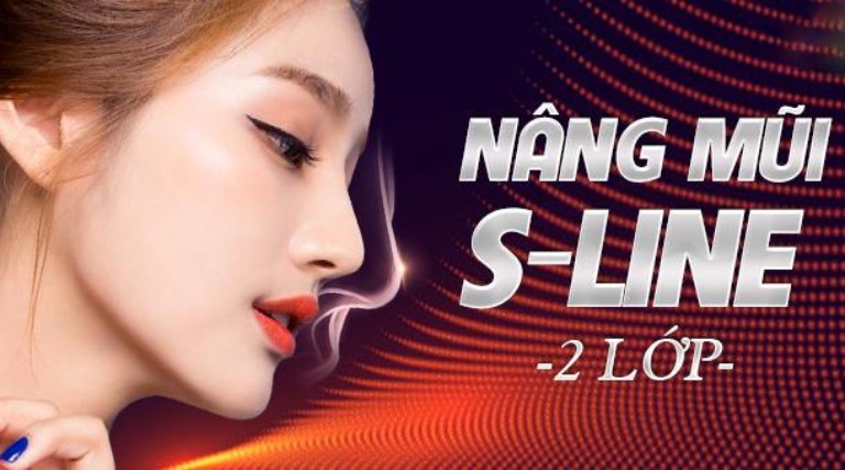 Nâng mũi S Line 2 lớp