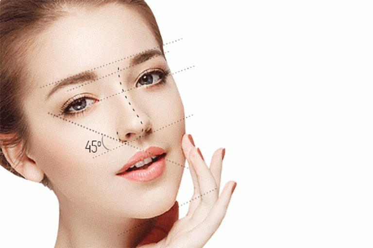 Nâng mũi S line 4D là gì