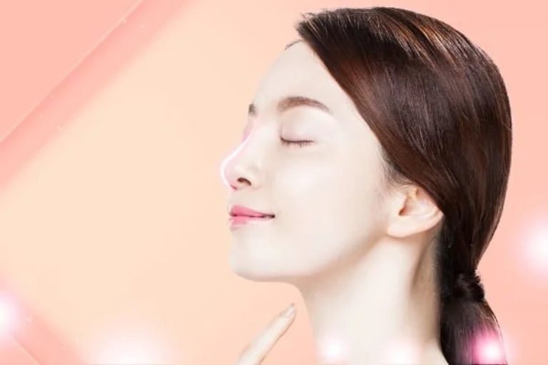 Ưu nhược điểm của nâng mũi S Line 4D