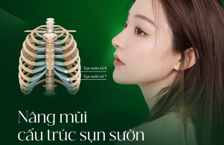 Nâng mũi sụn sườn có thể bị teo lại nhưng ít khi xảy ra