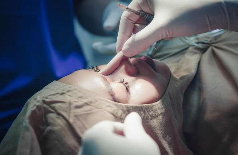 Top 5 Địa chỉ nâng mũi đẹp và uy tín tại Bình Định