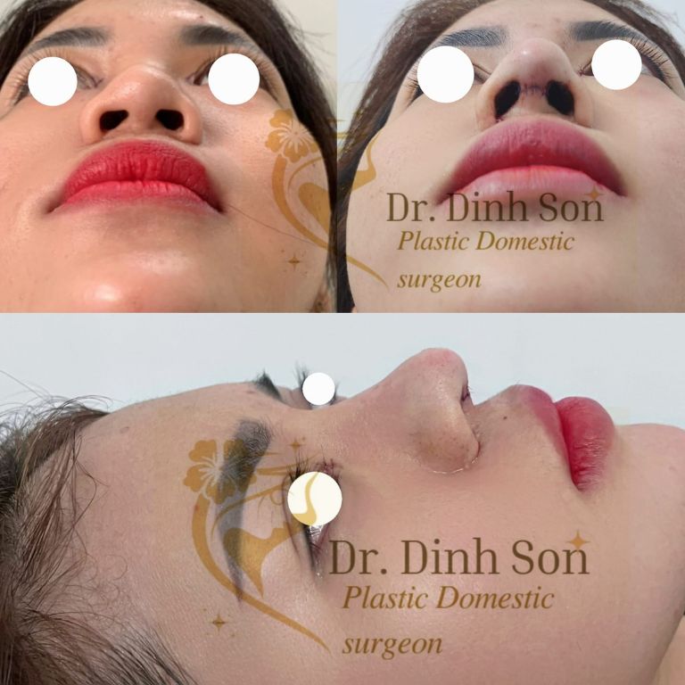 Thẩm mỹ Quy Nhơn Dr. Sơn