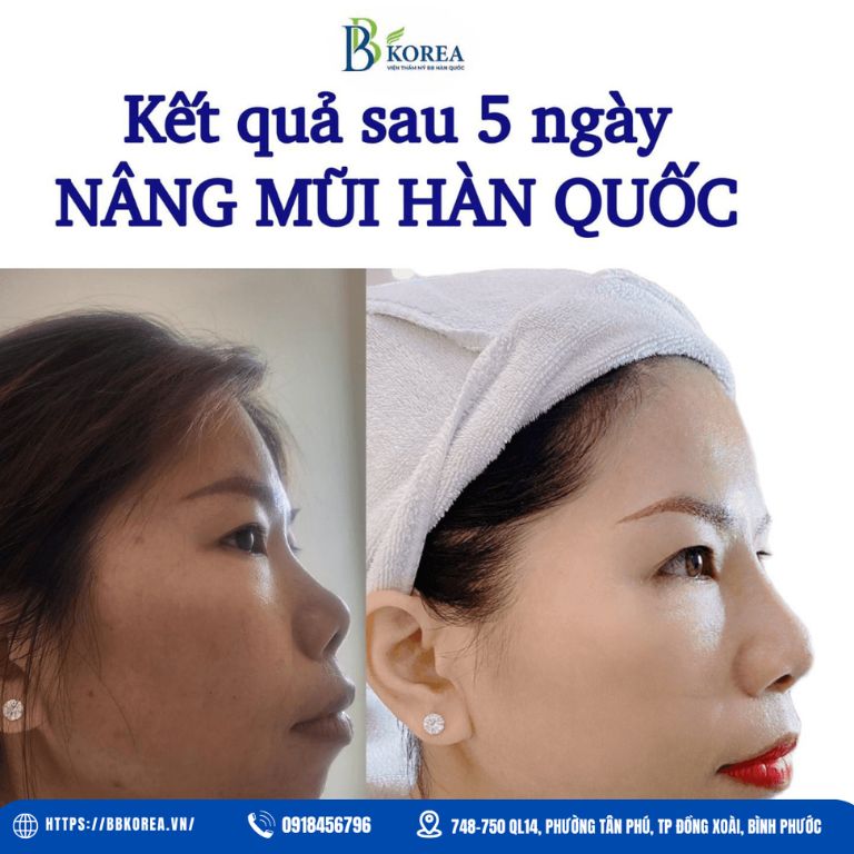 Viện thẩm mỹ BB KOREA