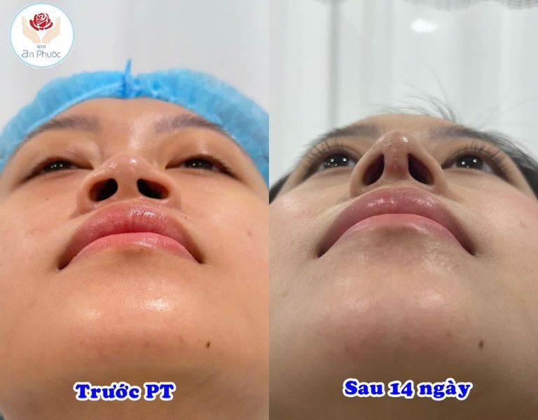 Phòng khám phẫu thuật thẩm mỹ - Bệnh viện đa khoa An Phước