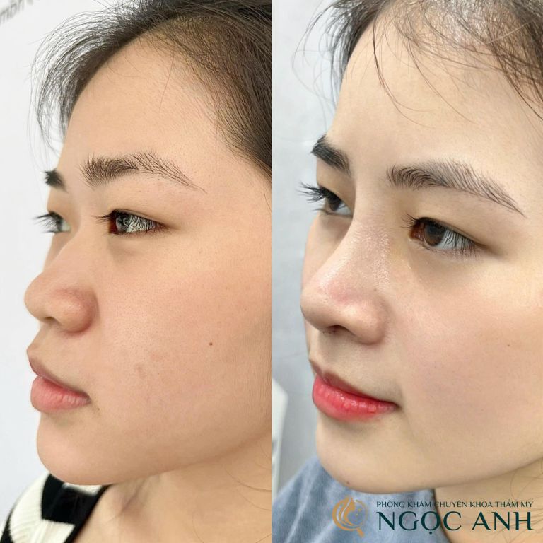Phòng khám chuyên khoa Thẩm mỹ Ngọc Anh