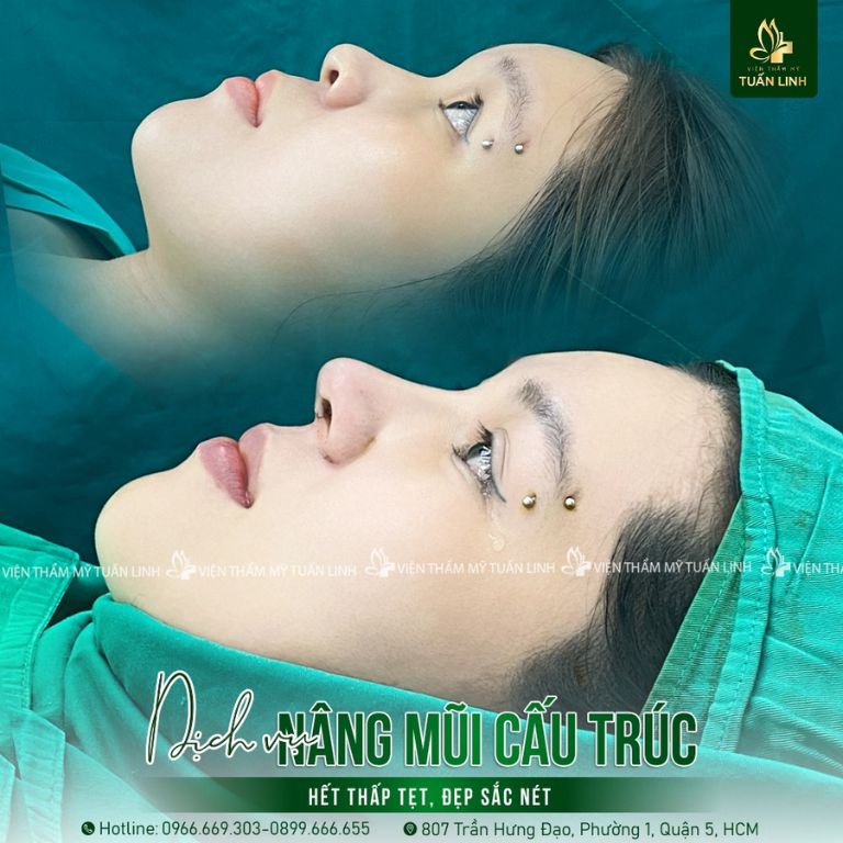 Viện Thẩm Mỹ Tuấn Linh