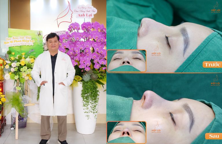 Bệnh viện phẫu thuật thẩm mỹ Hiệp Lợi