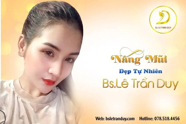nâng mũi tế bào gốc tại thẩm mỹ Galaxy