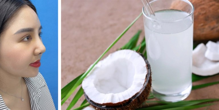 Nâng mũi bao lâu uống nước dừa được?
