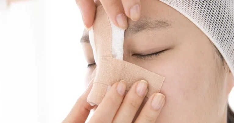 nâng mũi cấu trúc hay bọc sụn đẹp