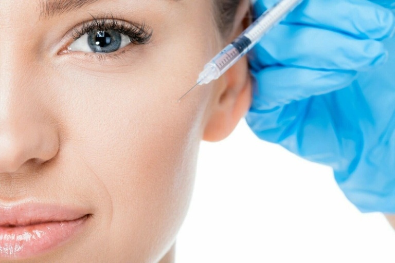 Tiêm Filler má là gì? Có nên không? Thông tin cần biết