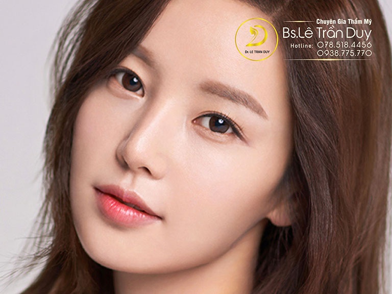 Tiêm filler má tại Dr. Lê Trần Duy