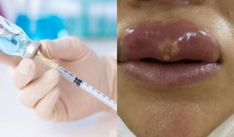 Nhiễm trùng, hoại tử mô có thể xảy ra nếu nếu tiêm sai kỹ thuật