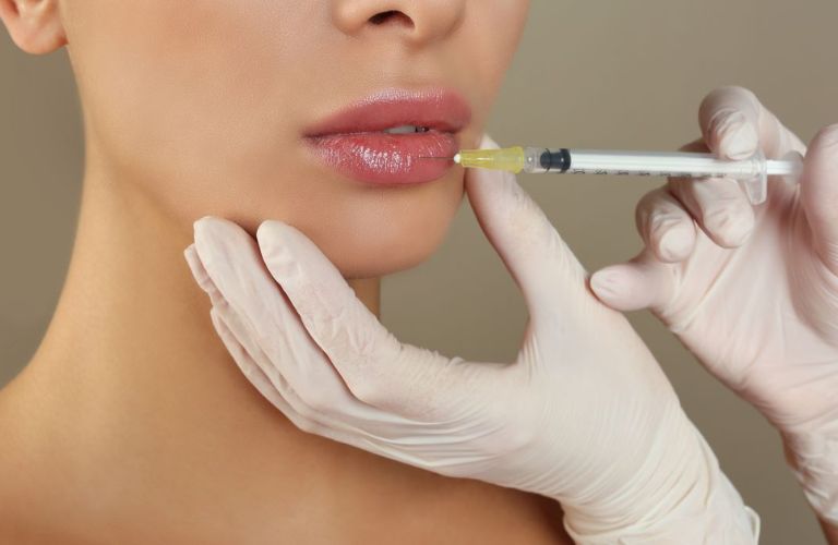Chi phí tiêm filler môi 1cc dao động từ 9.000.000đ - 12.000.000 VNĐ