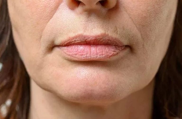 Hiệu quả không kéo dài vĩnh viễn
