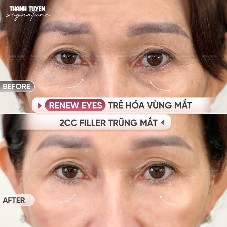 Thẩm Mỹ Viện Thanh Tuyền