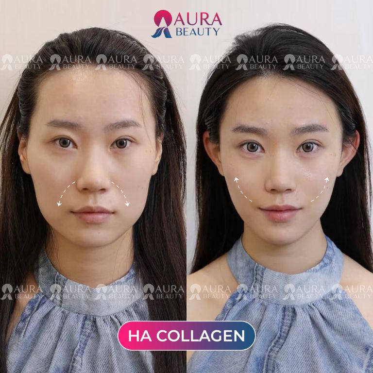 Thẩm mỹ viện quốc tế Aura